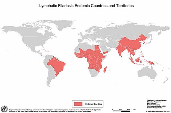 filariasis-map